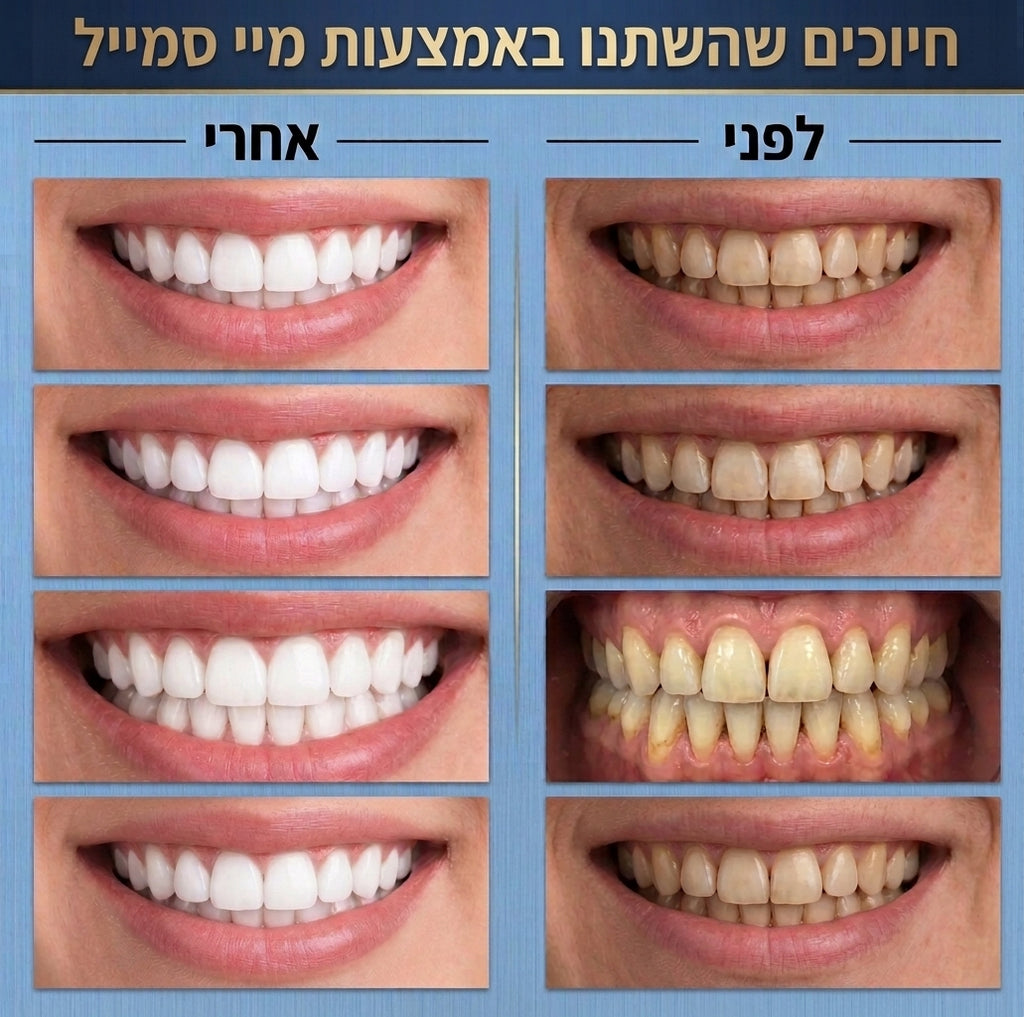 מארז ההלבנה הרשמי | MySmile PRO™